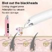 Picture of Blackhead Remover Vacuum Pore Cleaner Facial Deep Cleaning Beauty Tools (Pink)