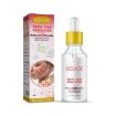 Picture of EELHOE 30ml/Bottle Anti Mole And Wart Liquid Dark Spot Tag Remover Skin Essence