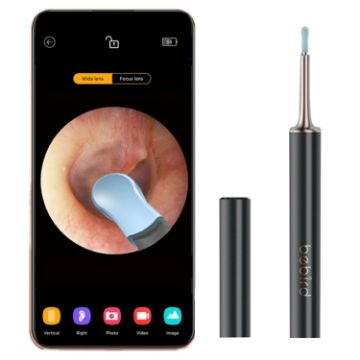 Bebird T15 Smart Visible Ear Pick Set - Star Black Luminous Edition - 1