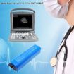 Battery for Chison ECO 6/5/3 Portable Ultrasound (p/n 33-00012-00) - 4